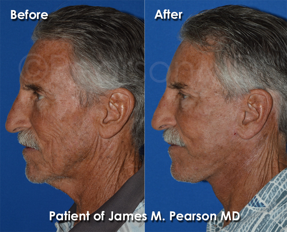 Pearson Cosmetic Surgery