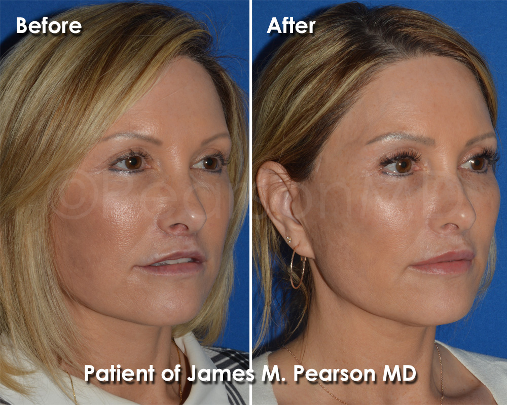 Dr. Pearson Plastic Surgery