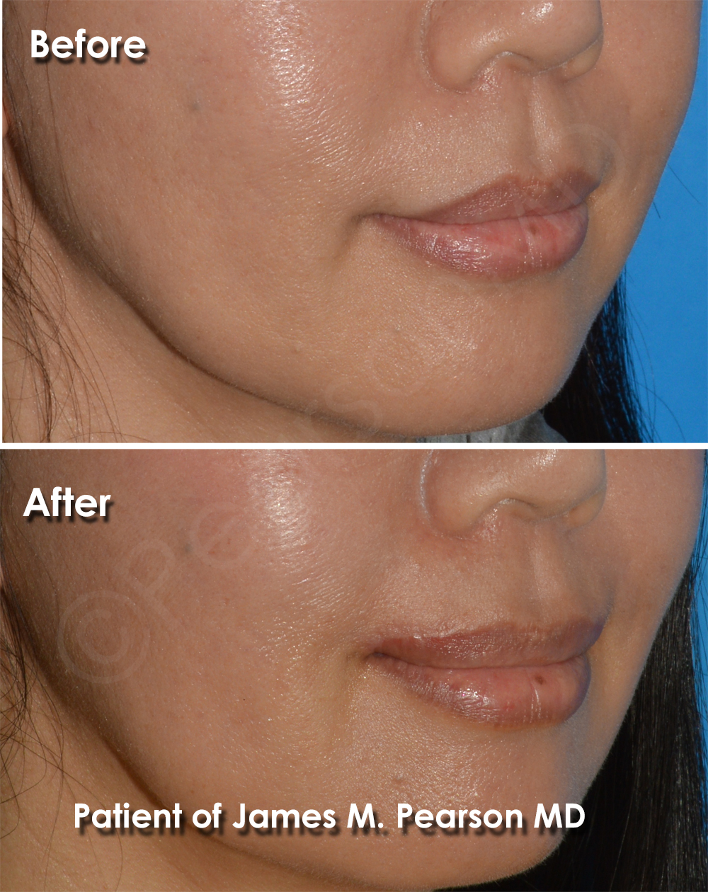 Pearson Plastic Surgery
