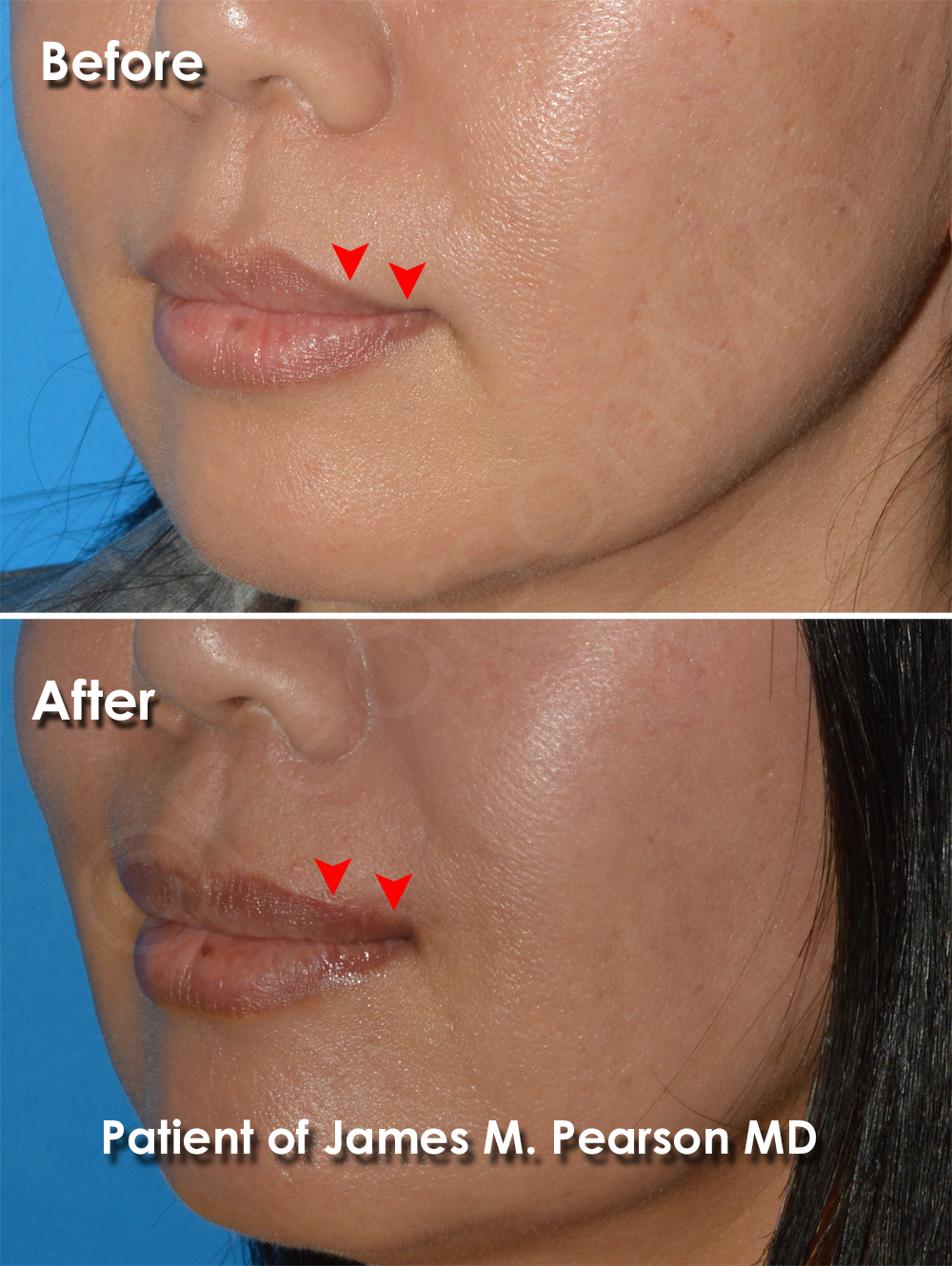 Dr. Pearson Plastic Surgery