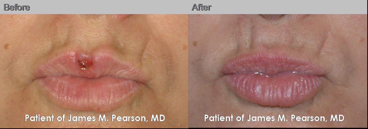Photo Pearson Reconstructive Surgery