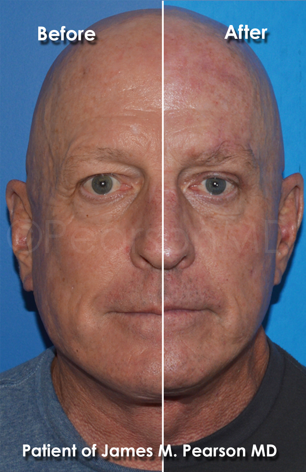 Pearson Plastic Surgery