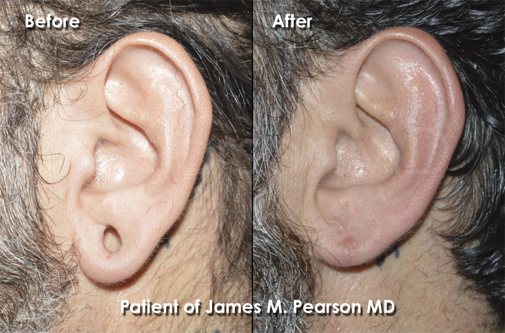 Dr. Pearson Plastic Surgery