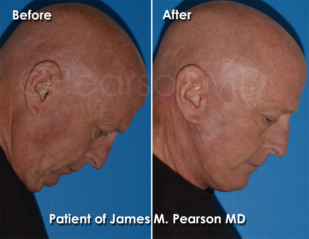 Pearson Plastic Surgery