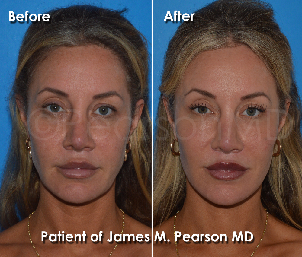 Pearson Plastic Surgery