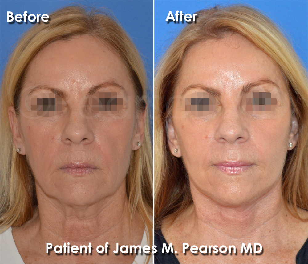 Pearson Cosmetic Surgery