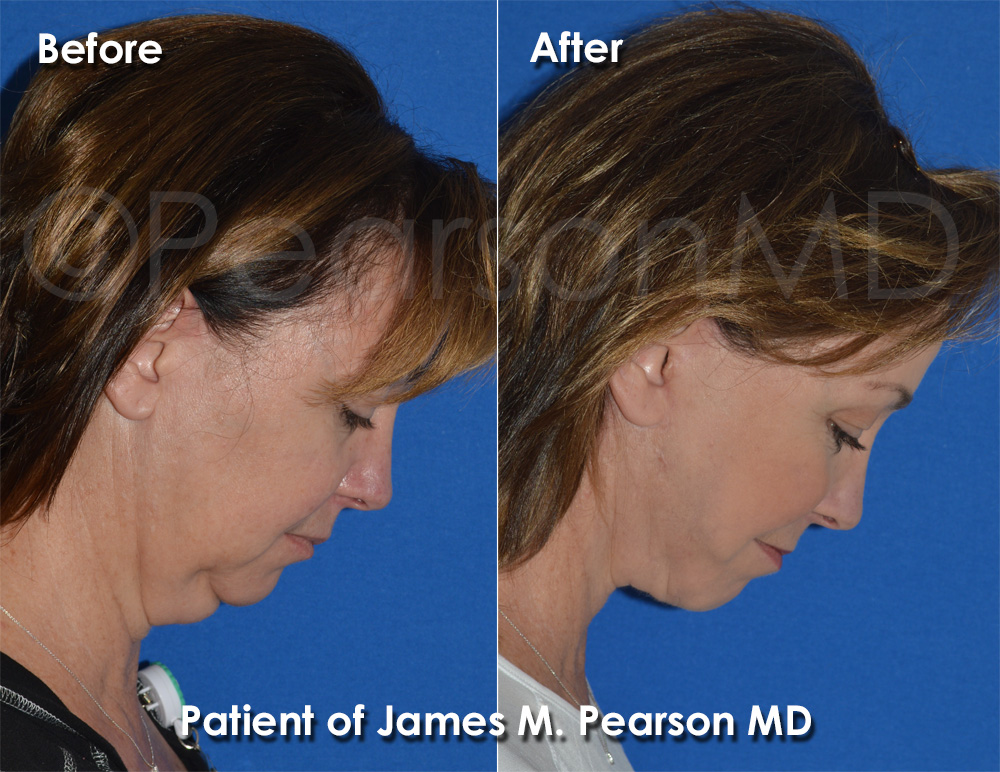Pearson Cosmetic Surgery