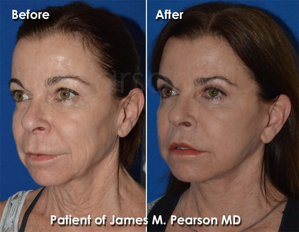 Pearson Cosmetic Surgery