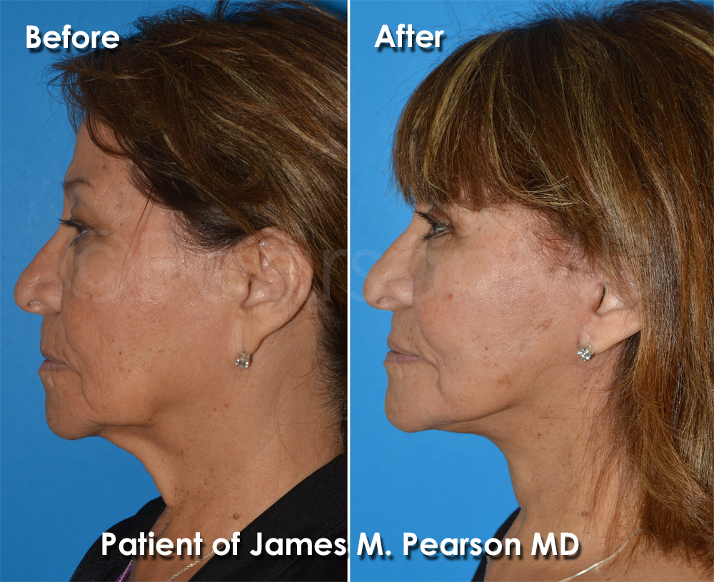 Dr. Pearson Plastic Surgery