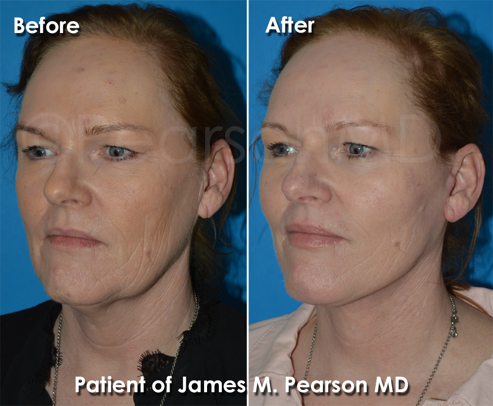 Dr. Pearson Plastic Surgery