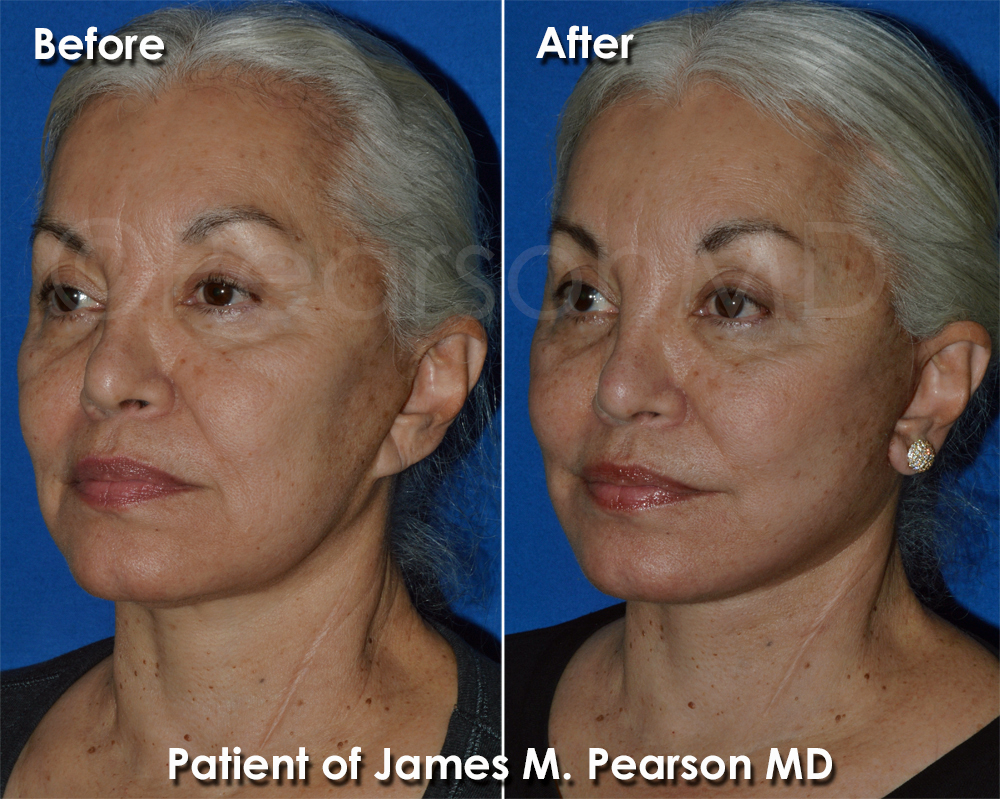 Pearson Cosmetic Surgery