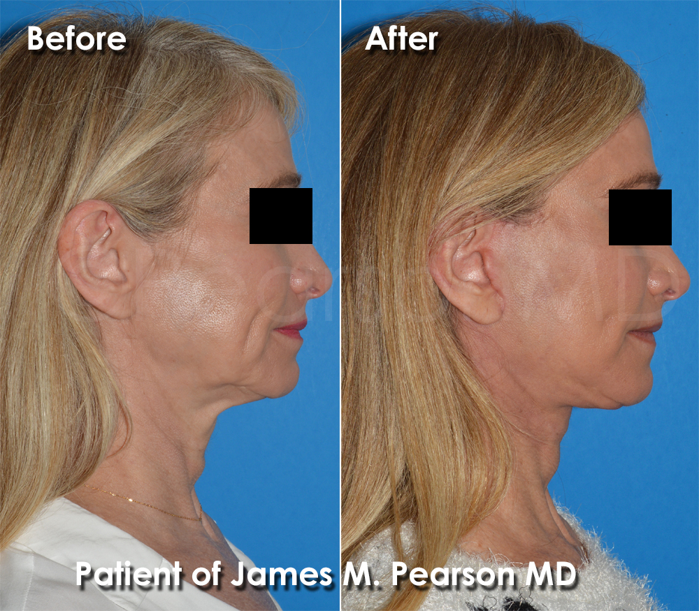Pearson Cosmetic Surgery