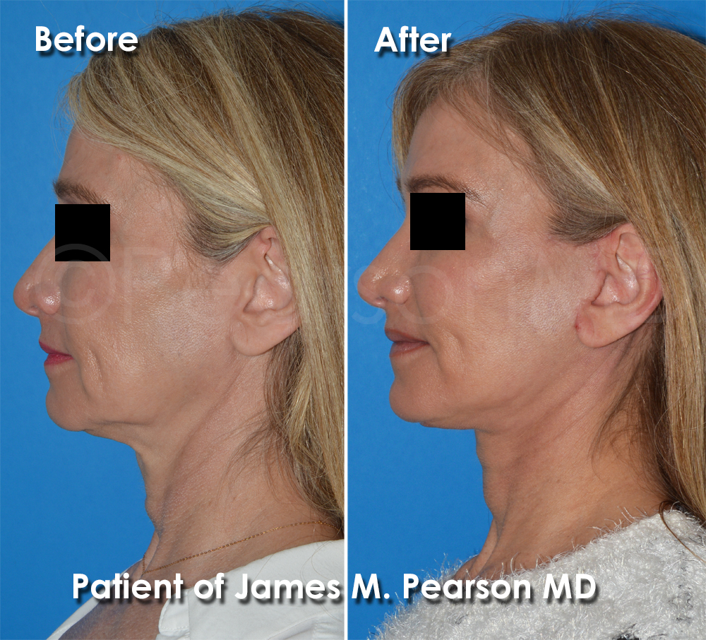 Dr. Pearson Plastic Surgery