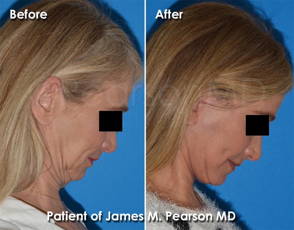 Pearson Cosmetic Surgery