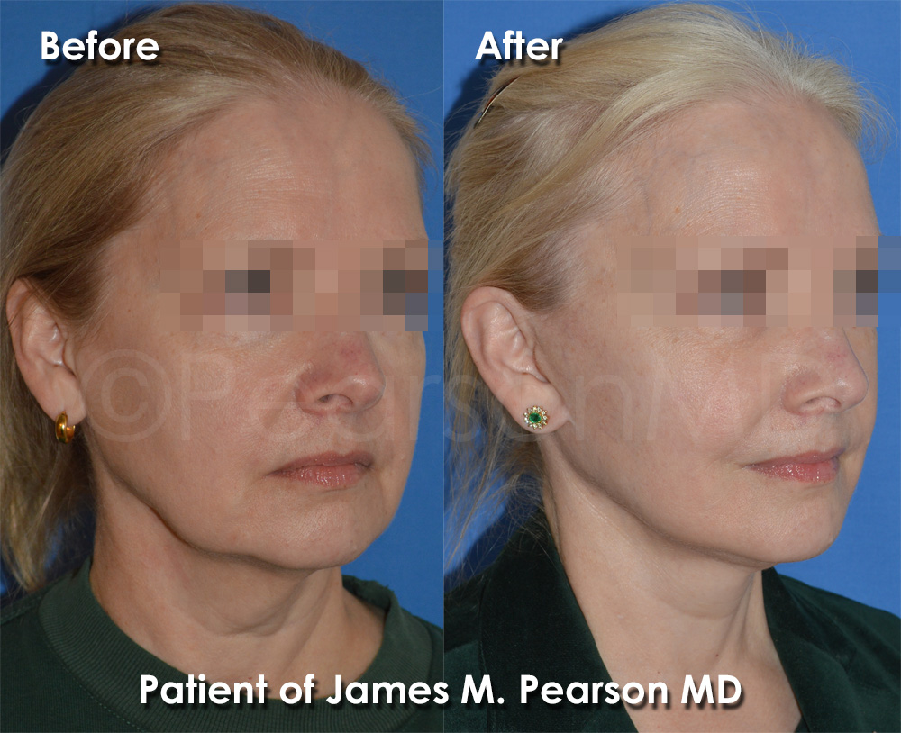 Pearson Cosmetic Surgery