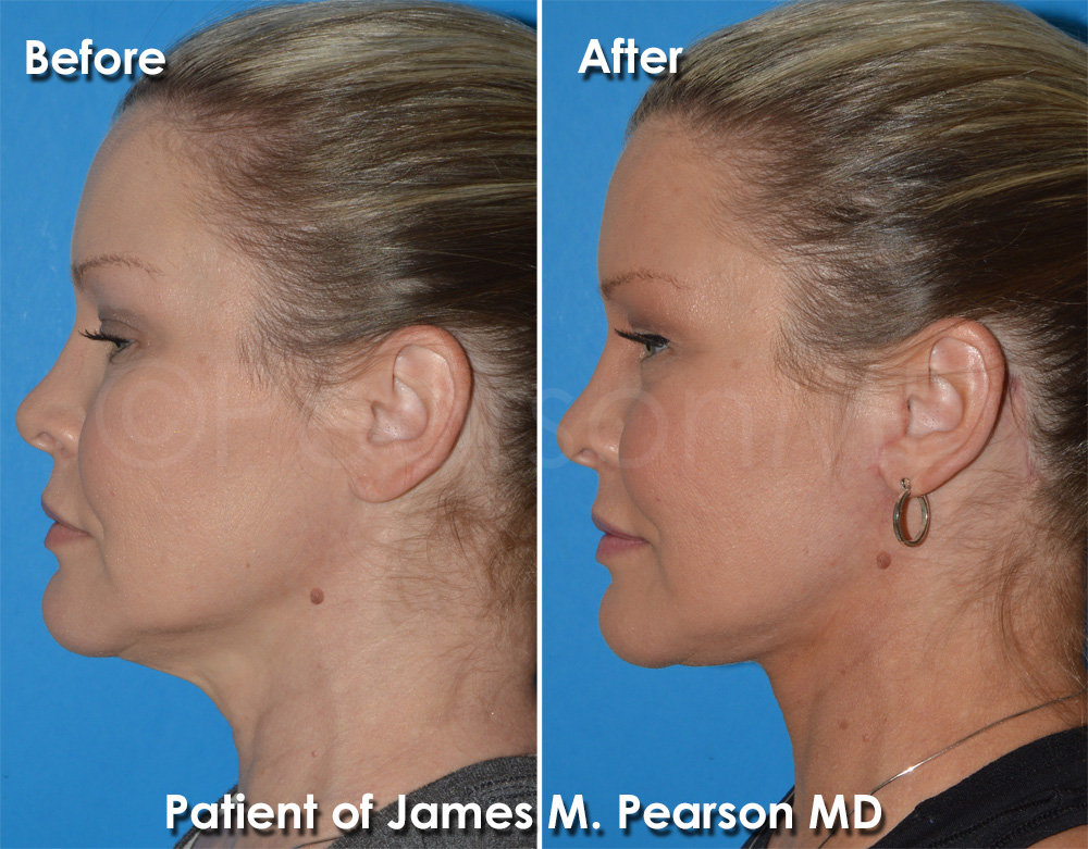 Pearson Cosmetic Surgery