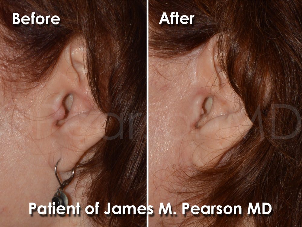 Pearson Cosmetic Surgery