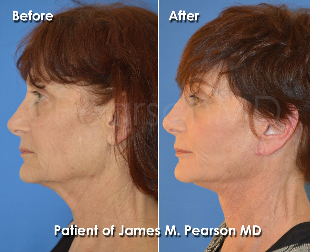 Pearson Cosmetic Surgery