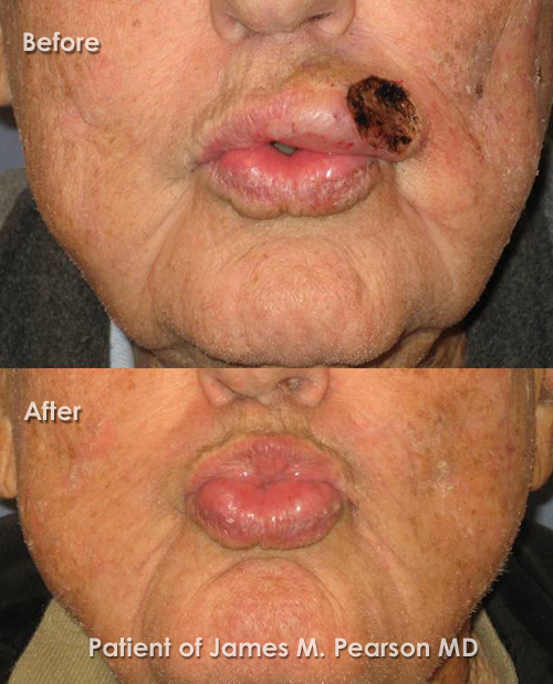 Photo Pearson Reconstructive Surgery