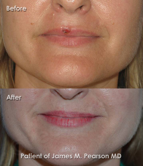 Photo Pearson Reconstructive Surgery
