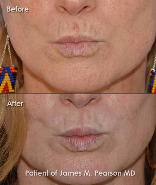 Photo Pearson Reconstructive Surgery
