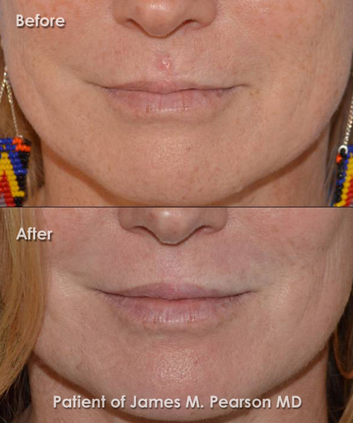 Photo Pearson Reconstructive Surgery