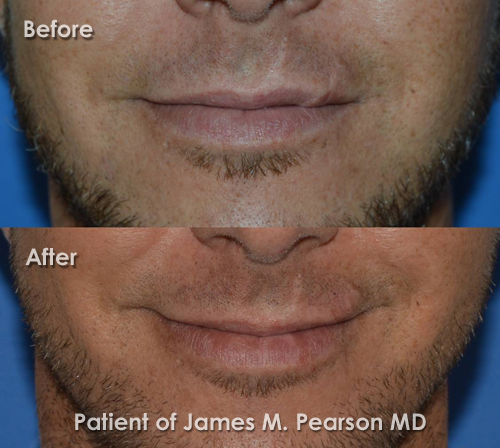 Photo Pearson Reconstructive Surgery