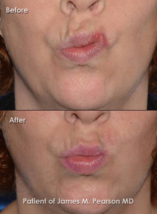 Photo Pearson Reconstructive Surgery
