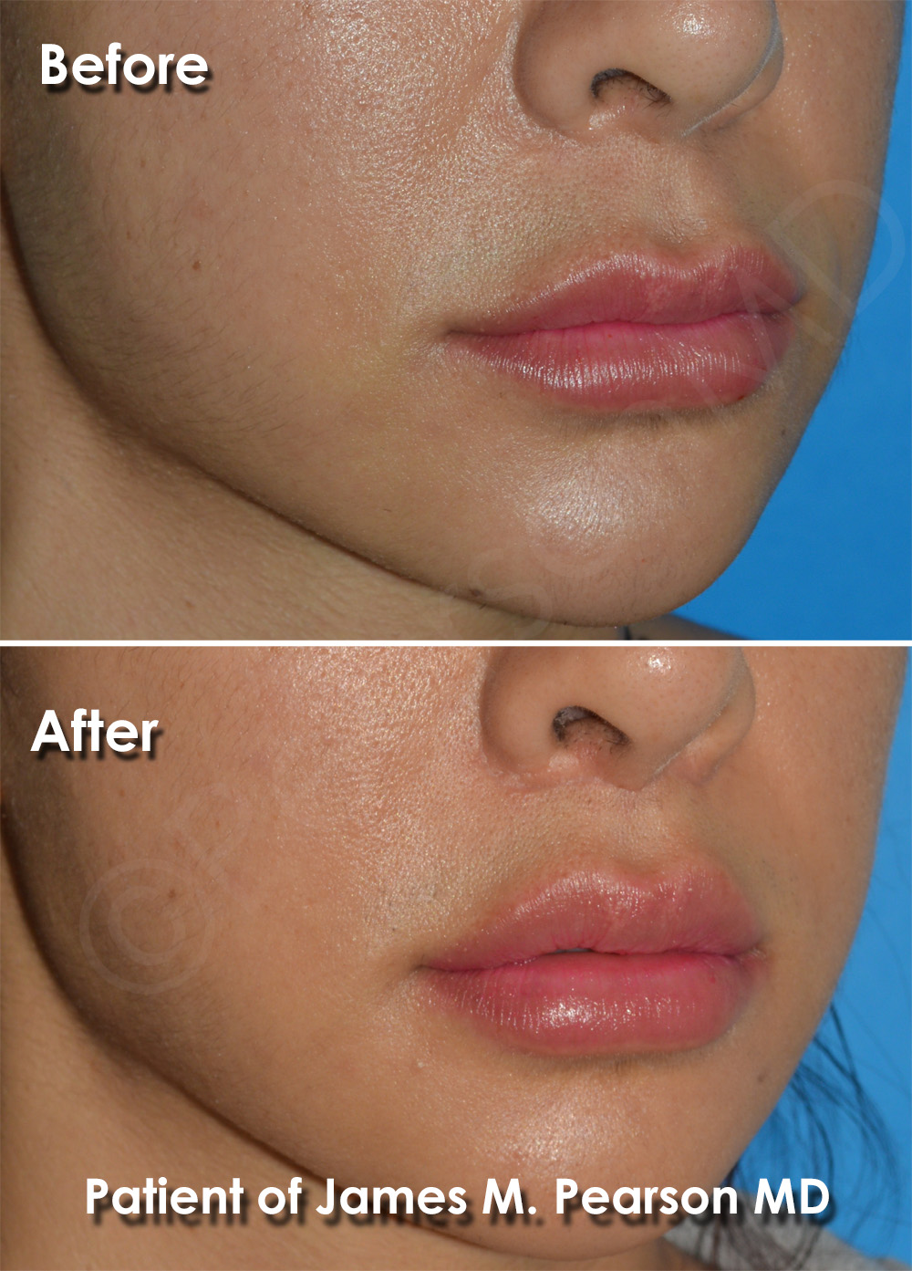 Pearson Cosmetic Surgery