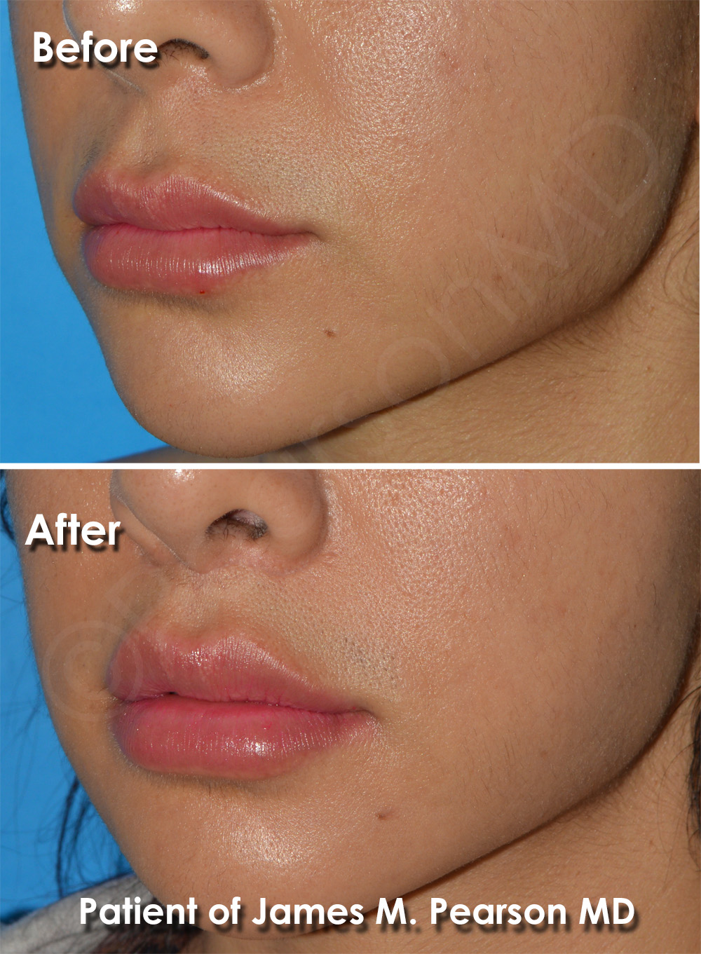 Pearson Plastic Surgery