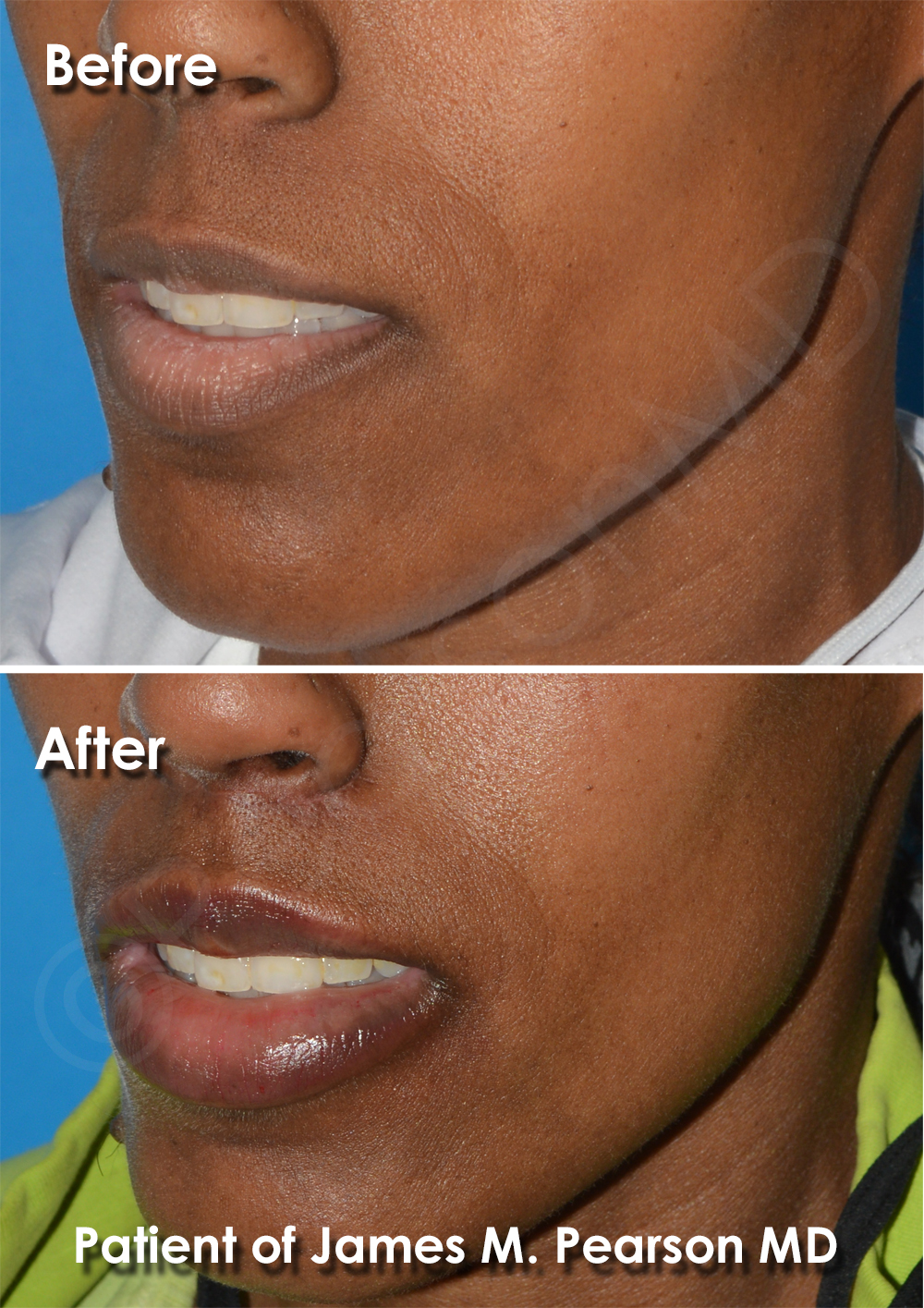 Pearson Plastic Surgery
