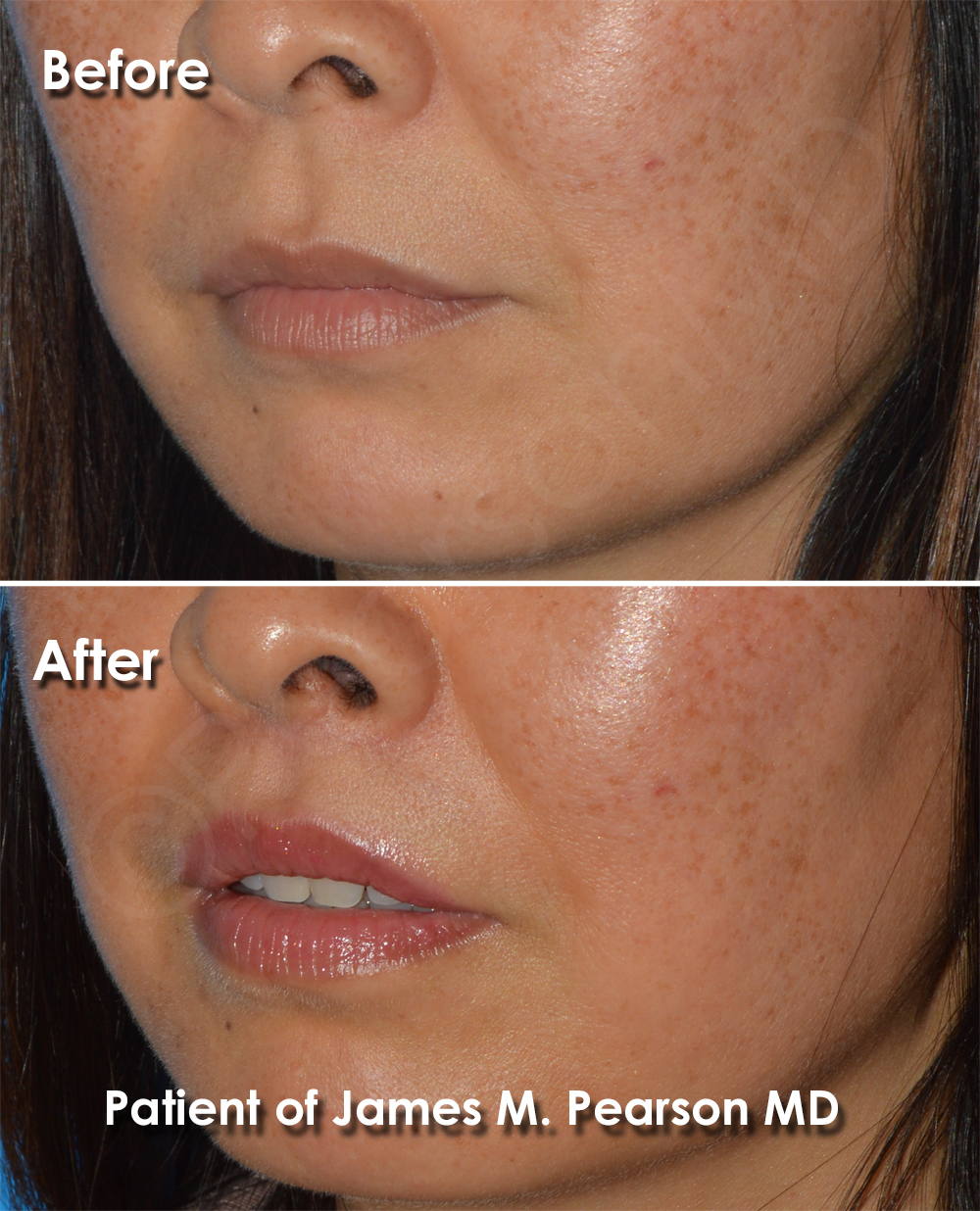 Pearson Cosmetic Surgery