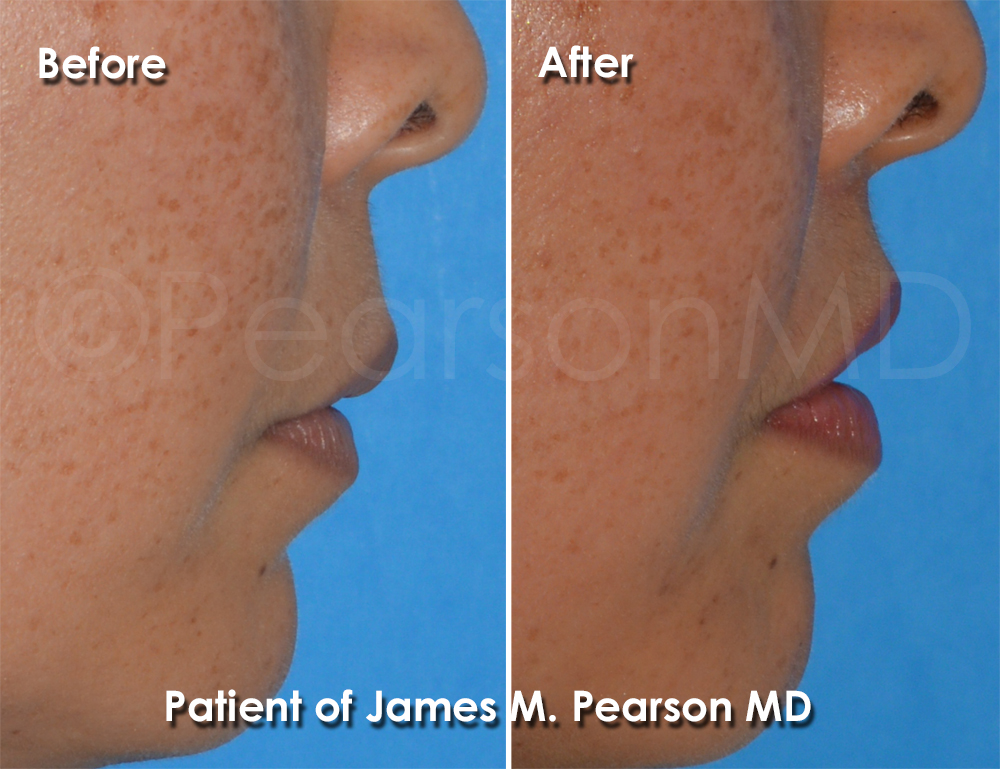 Dr. Pearson Cosmetic Surgery
