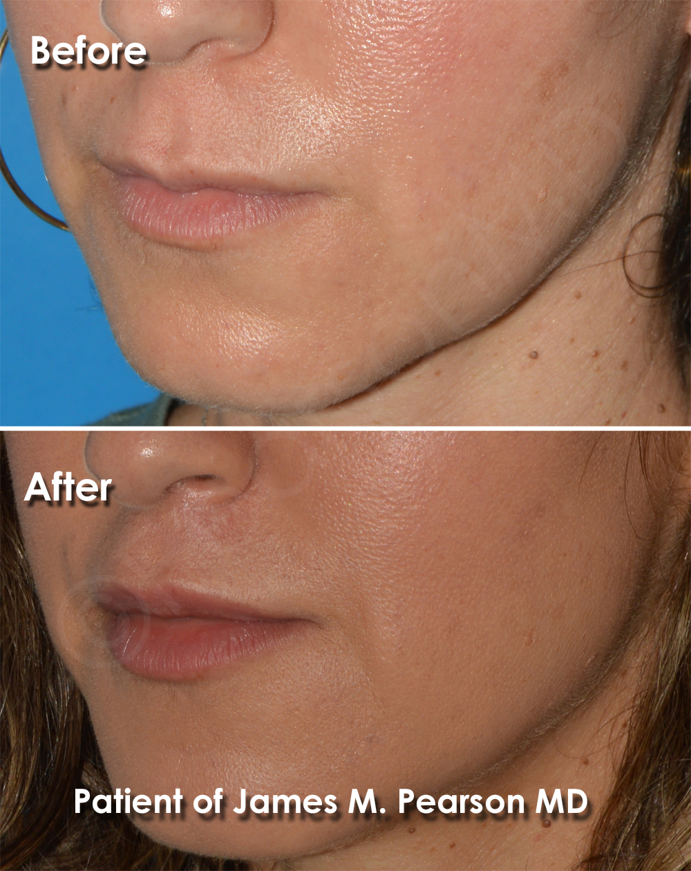 Pearson Plastic Surgery