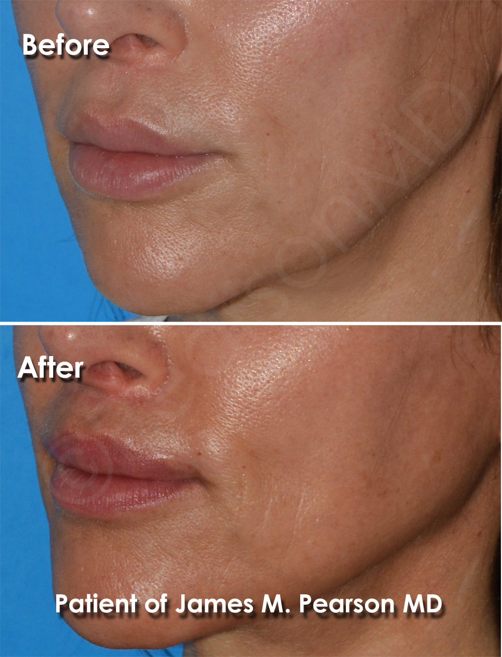 Dr. Pearson Plastic Surgery