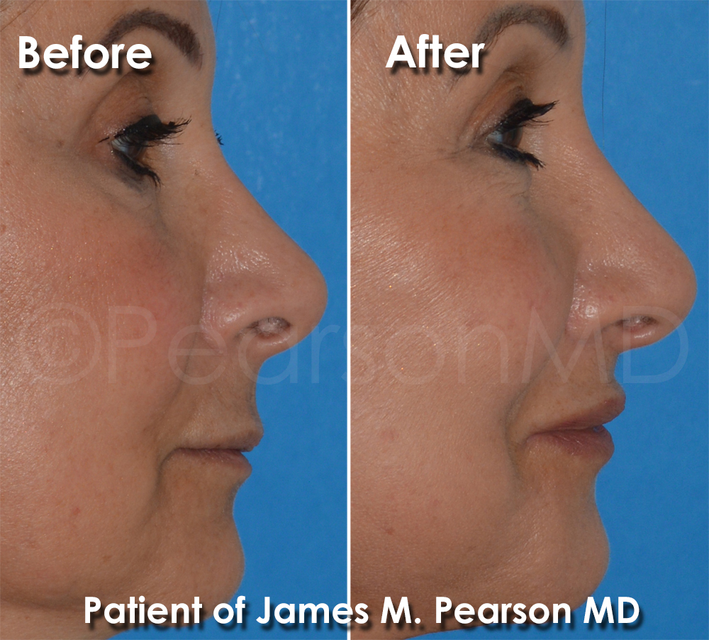 Dr. Pearson Plastic Surgery