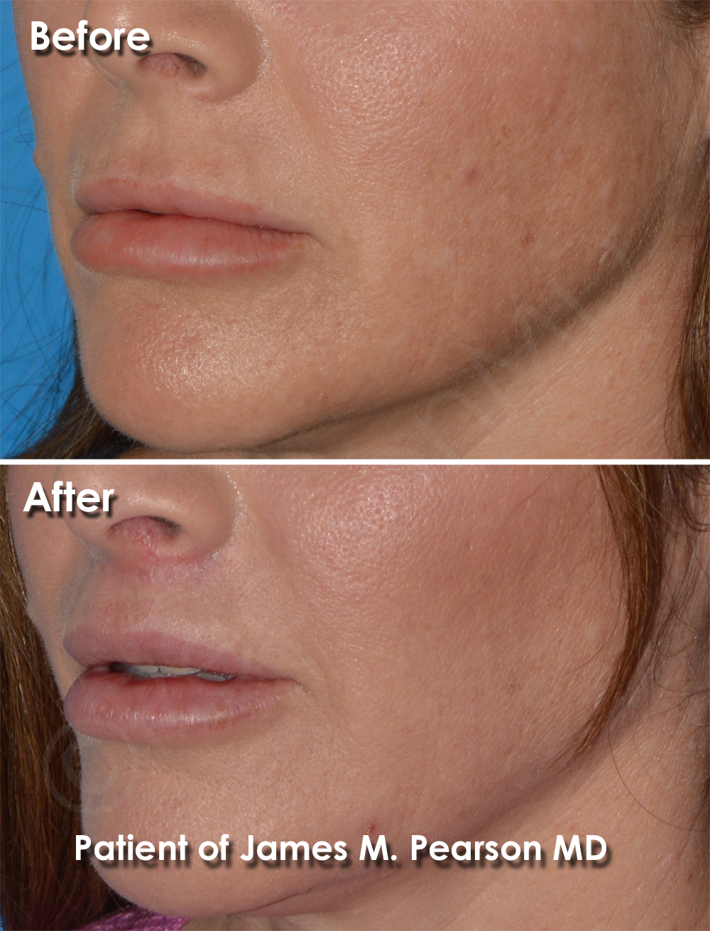 Dr. Pearson Facial Plastic Surgeon