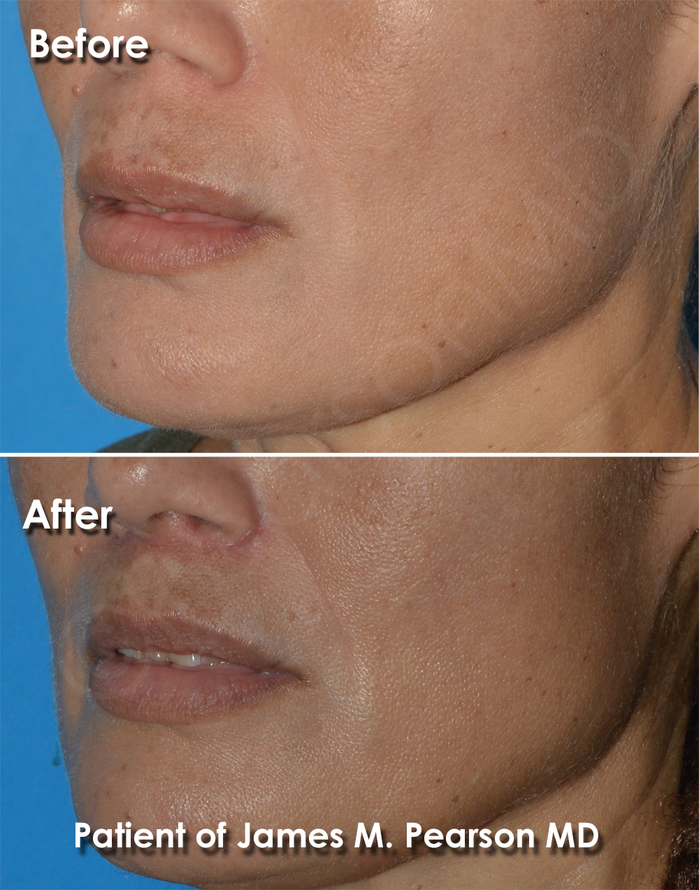Pearson Plastic Surgery