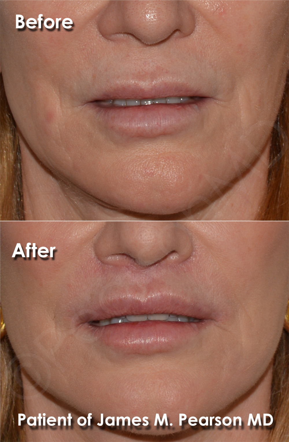 Pearson Plastic Surgery
