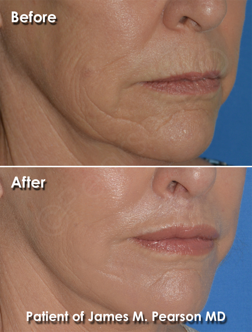 Pearson Cosmetic Surgery