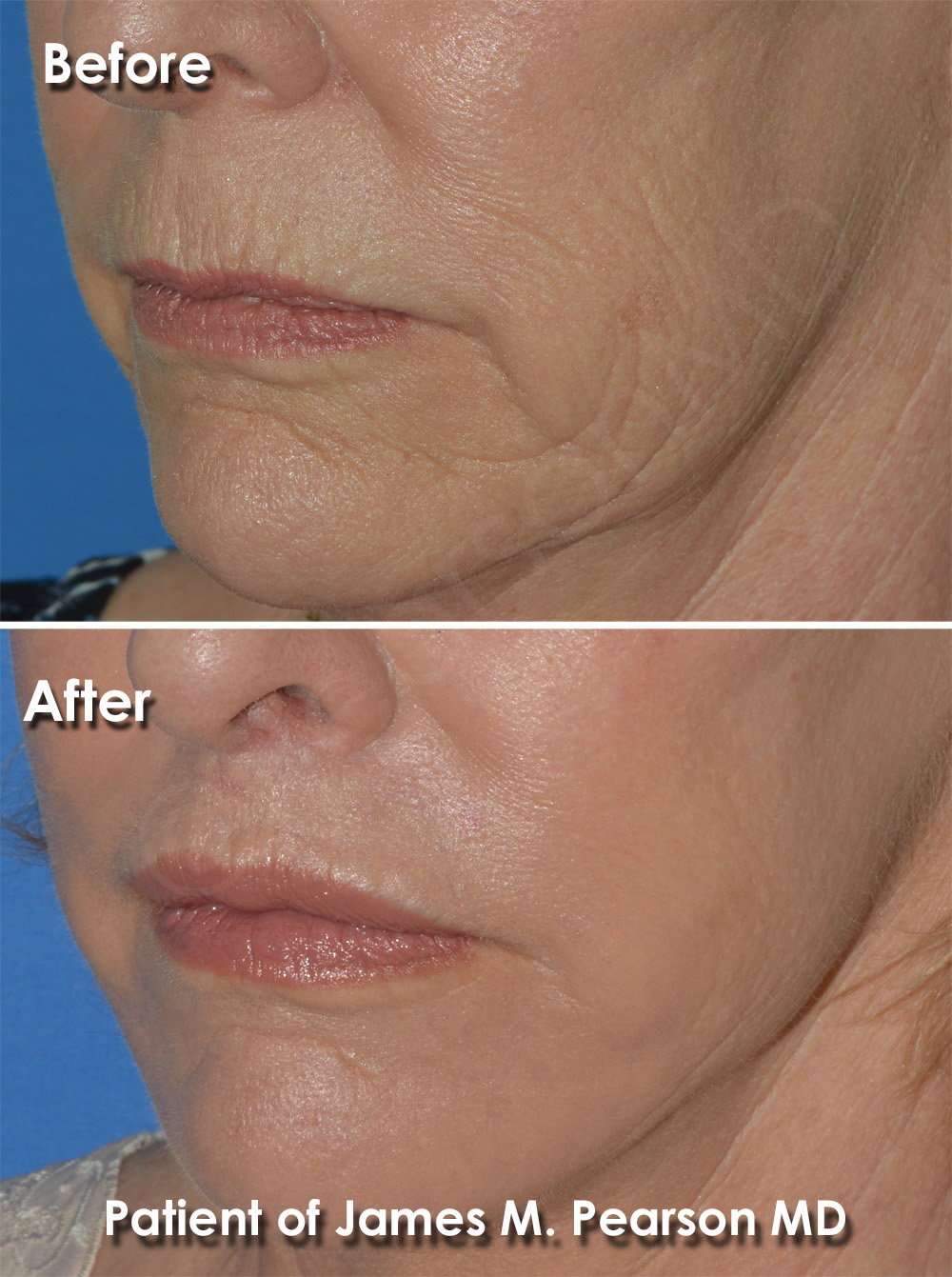 Dr. Pearson Plastic Surgery