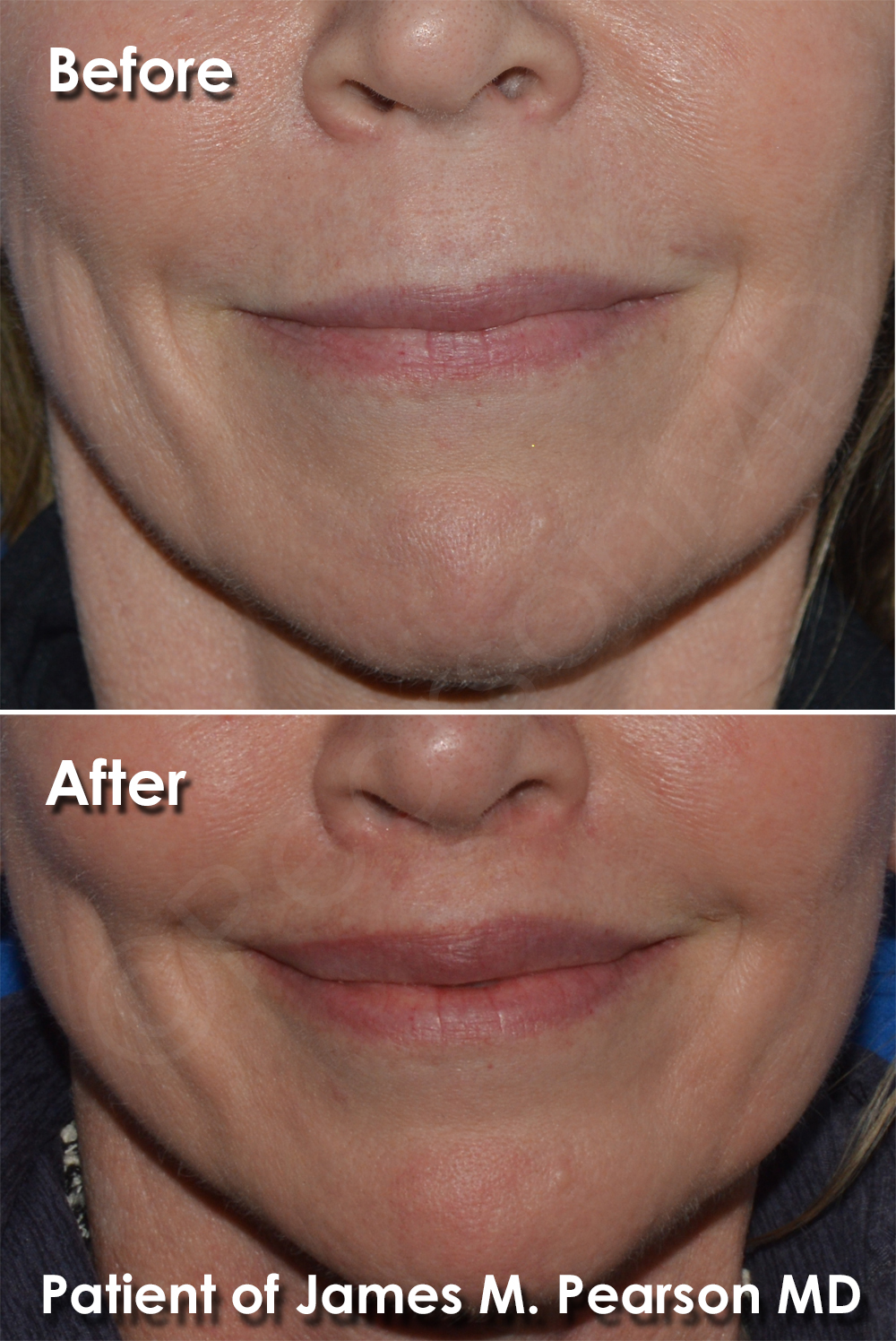 Pearson Cosmetic Surgery