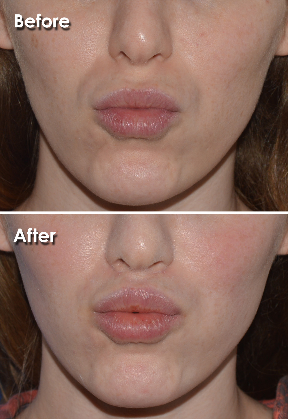 Pearson Plastic Surgery