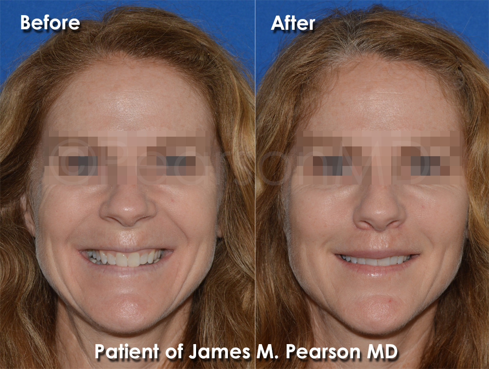 Dr. Pearson Plastic Surgery