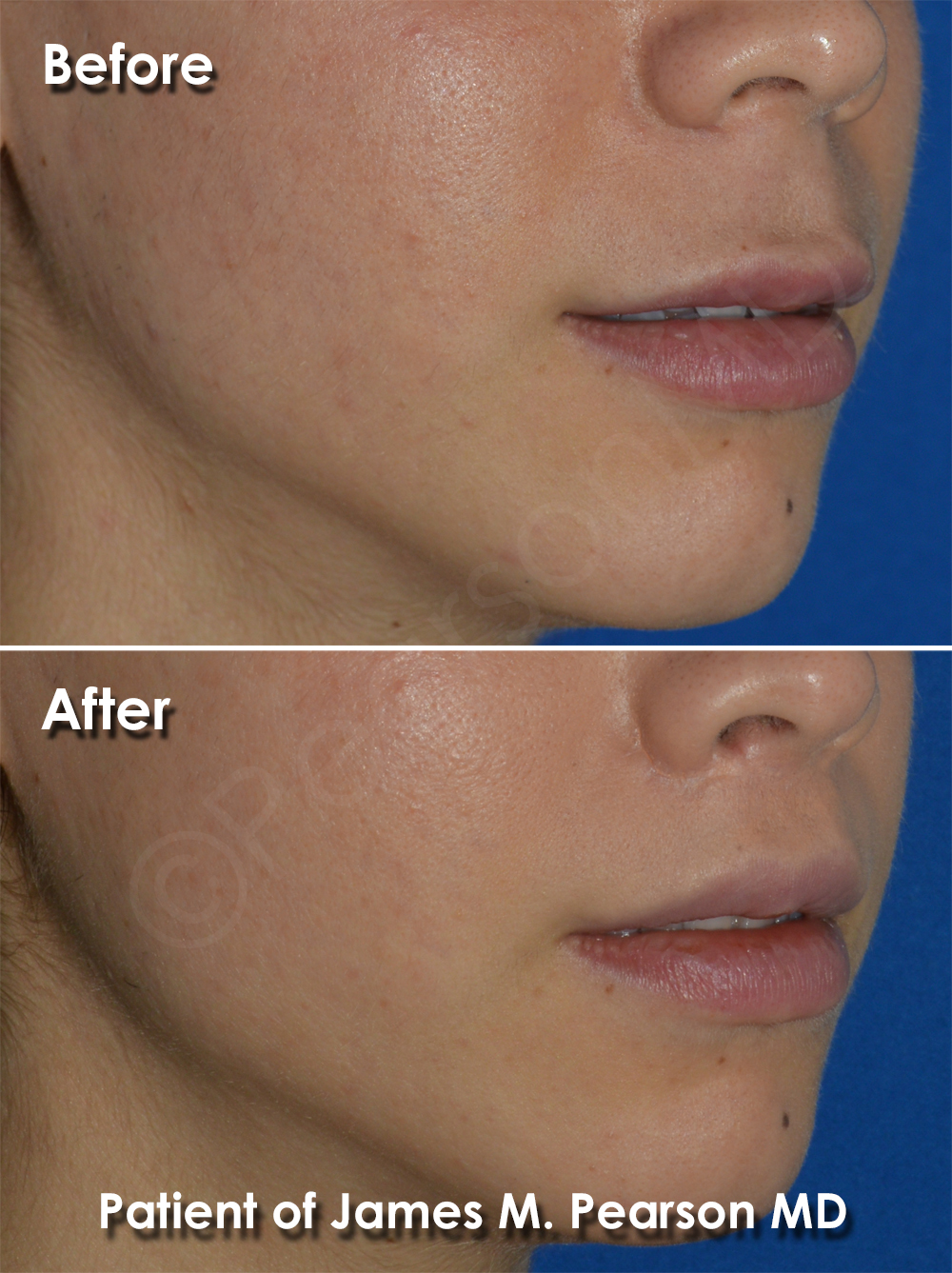 Pearson Cosmetic Surgery