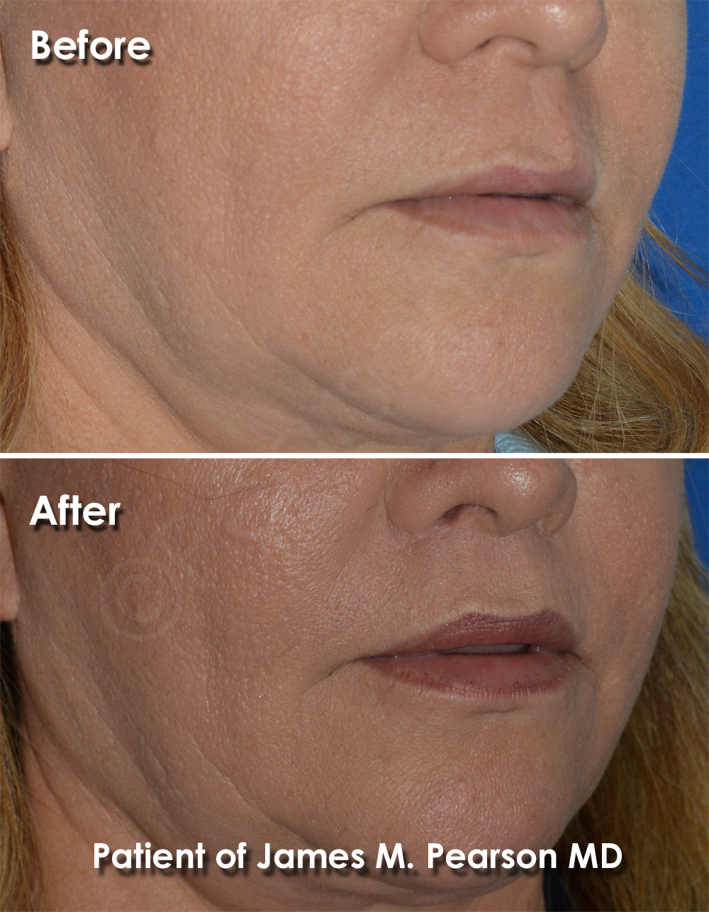 Pearson Cosmetic Surgery