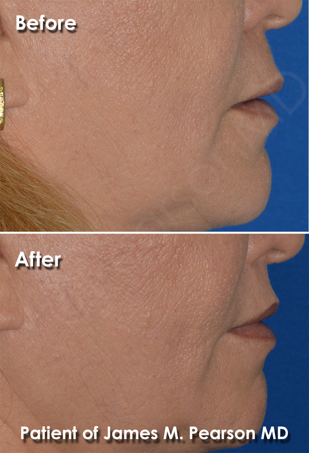 Dr. Pearson Plastic Surgery