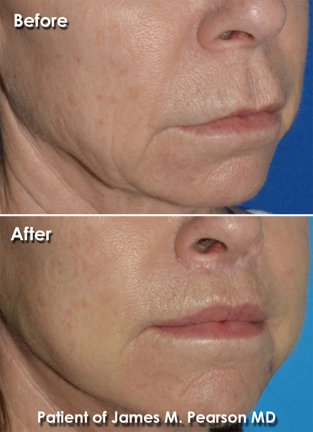 Pearson Cosmetic Surgery