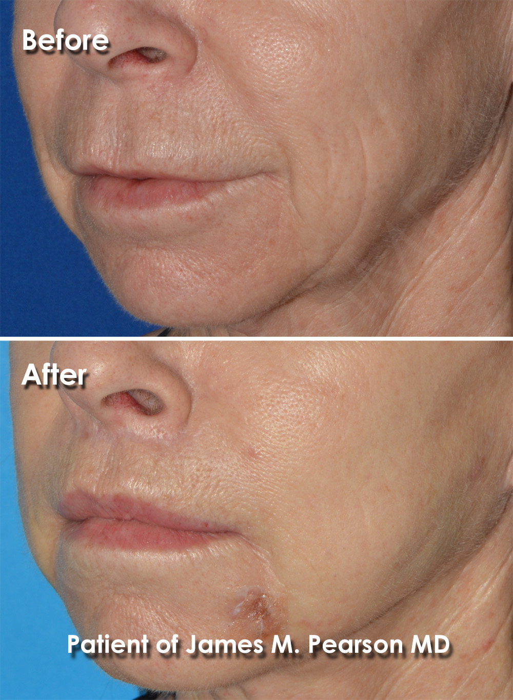 Pearson Plastic Surgery