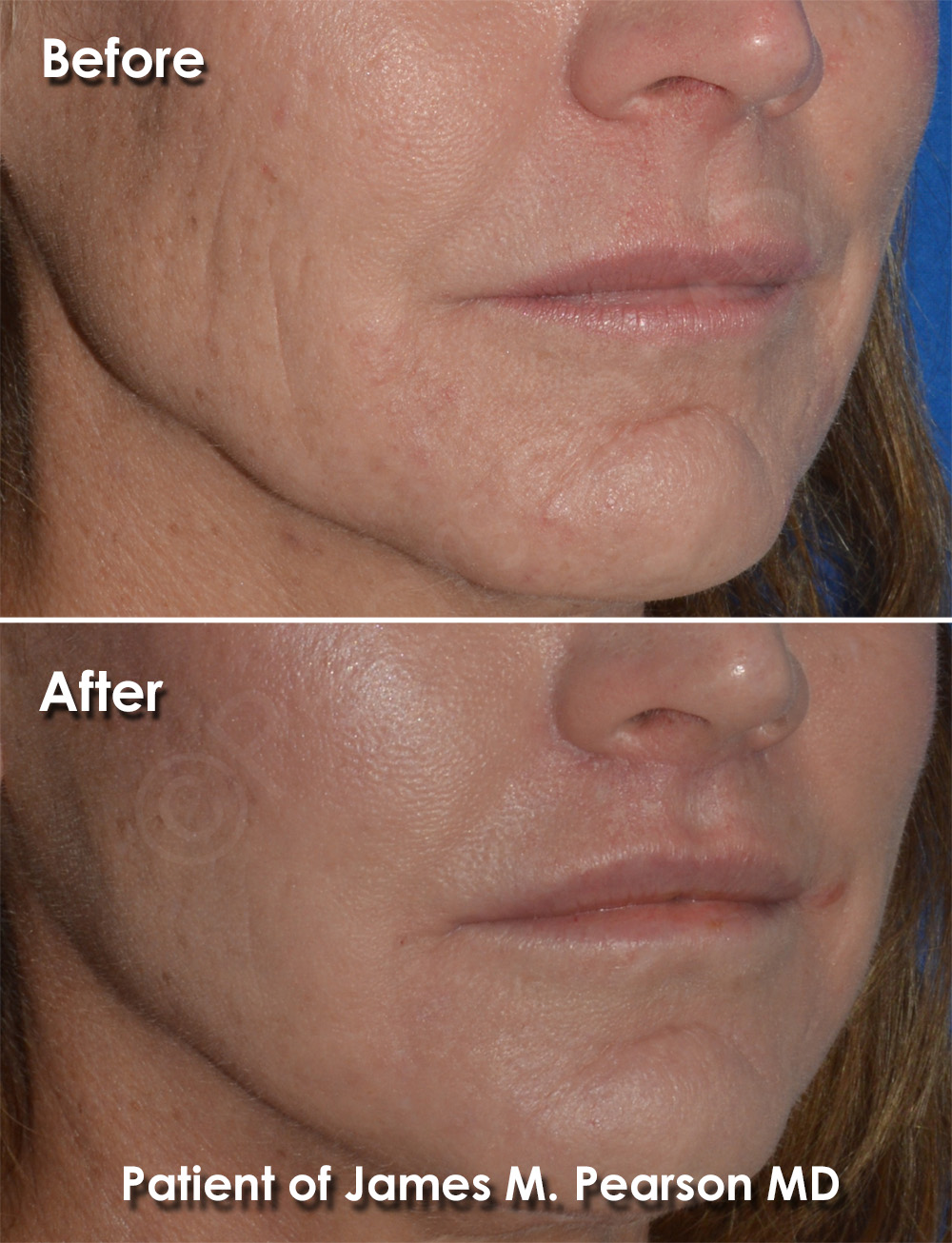 Pearson Cosmetic Surgery
